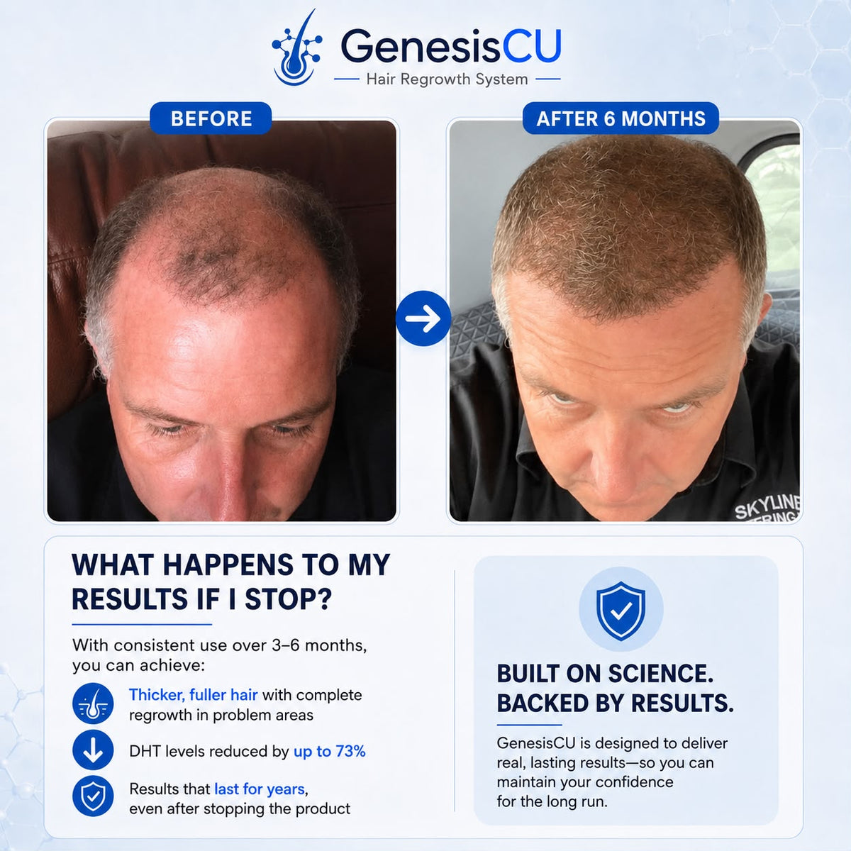 GenesisCU™ GHK-Cu Hair Regrowth System (105mg)