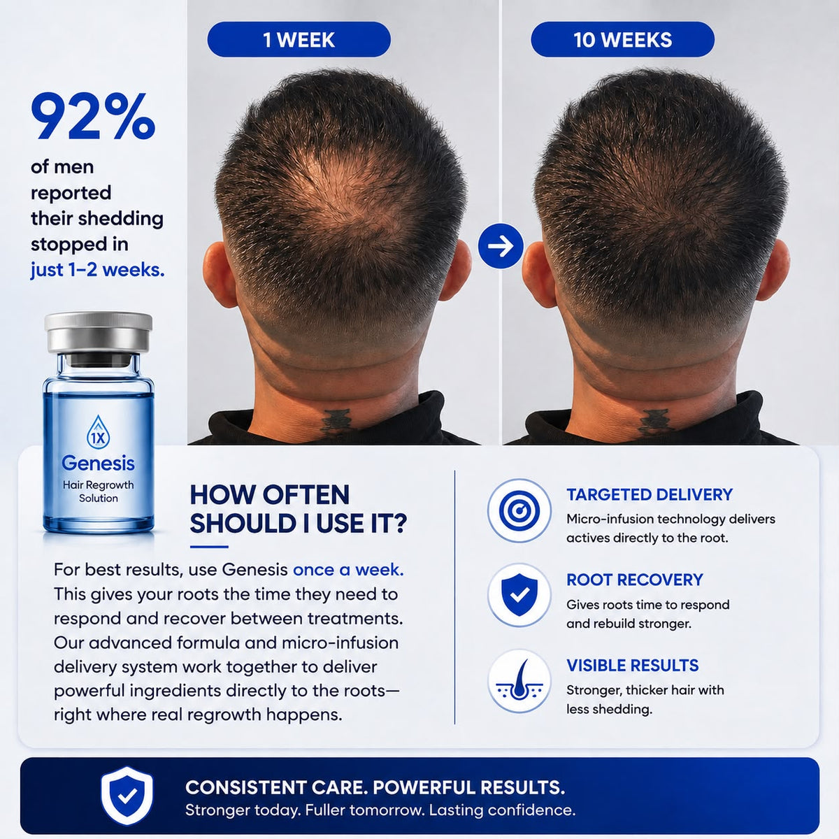 GenesisCU™ GHK-Cu Hair Regrowth System (105mg)