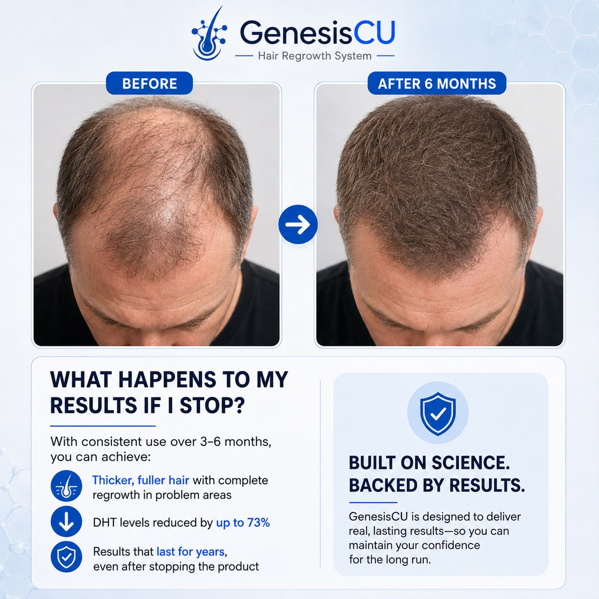 GenesisCU™ GHK-Cu Hair Regrowth System (105mg)